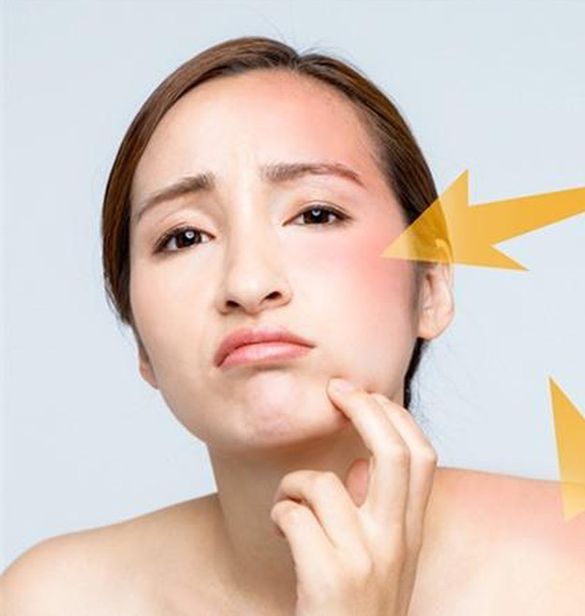 After Sun Phục hồi da sau nắng biển 